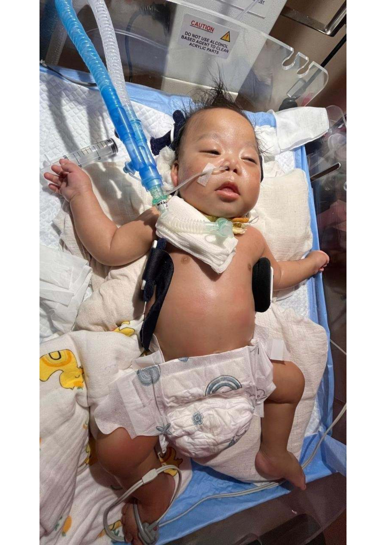 Urgent Appeal: Help Aryan to Get the Surgery He Needs!