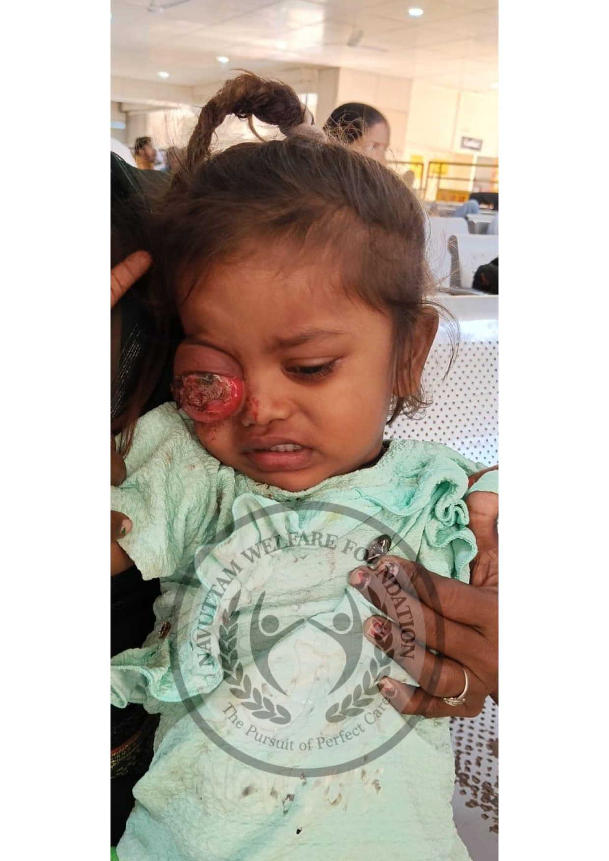 Urgent Appeal: Help Sonamati Get Life-Saving Treatment!