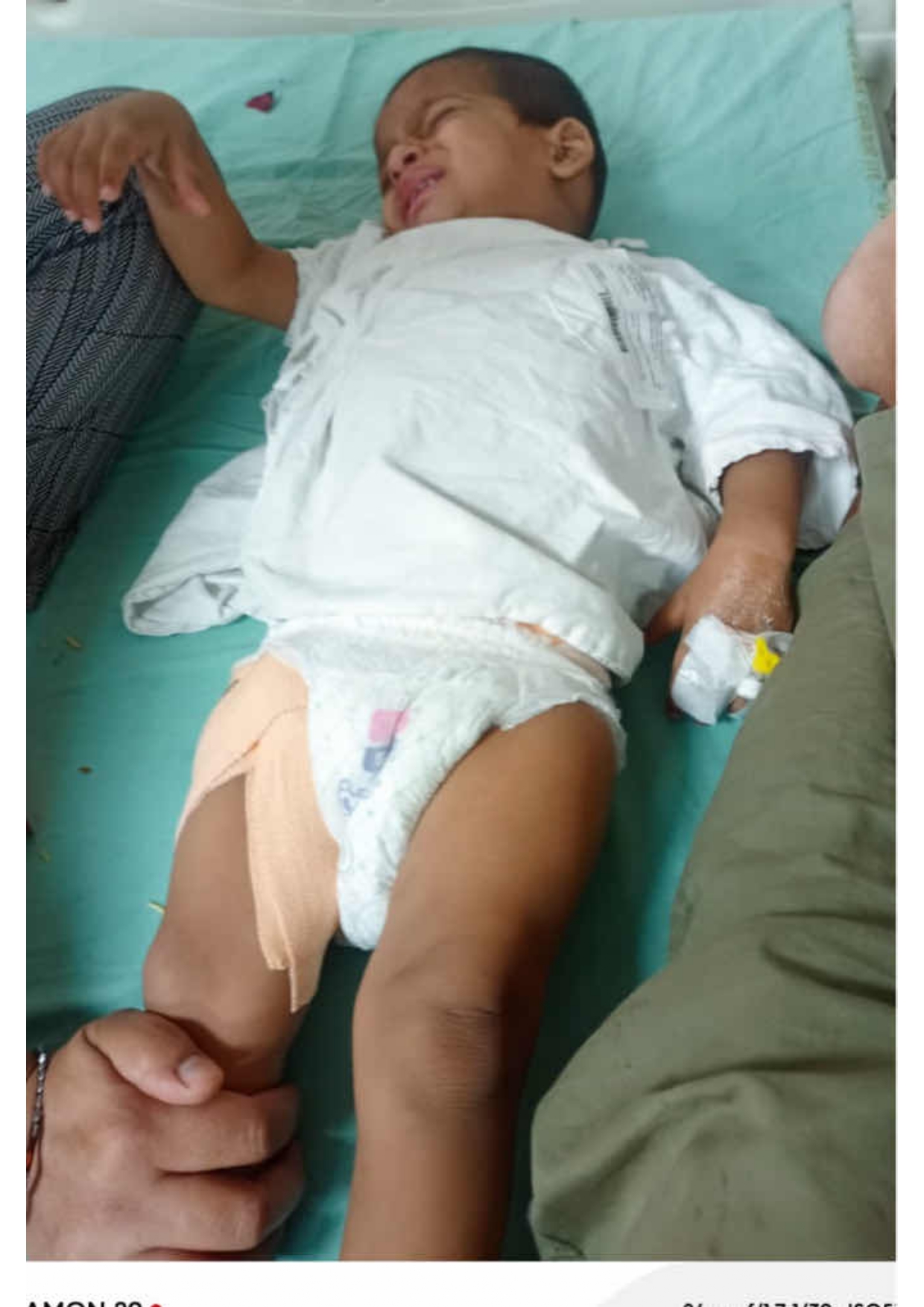 Urgent Appeal: Help Save 1-Year-Old Viraat’s Life – Battling Eye Cancer (Retinoblastoma)